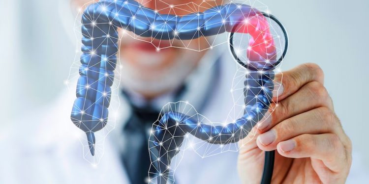 Aumentan los casos de cáncer colorrectal en menores de 50 años: la dieta y el estilo de vida, en la mira de los investigadores