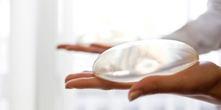 Implantes mamarios: todo lo que debes saber