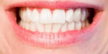 El ‘hacking dental’ arrasa en redes: consecuencias de una peligrosa tendencia