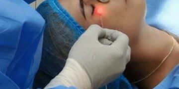 Clínica del Dr. Lee introduce técnica de Láser Lifting para rejuvenecer rostro y cuello sin cirugía