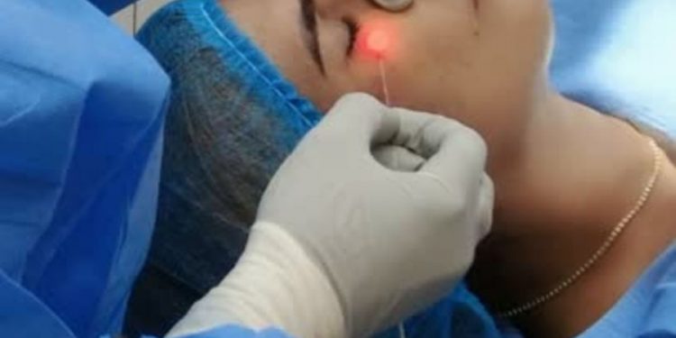 Clínica del Dr. Lee introduce técnica de Láser Lifting para rejuvenecer rostro y cuello sin cirugía
