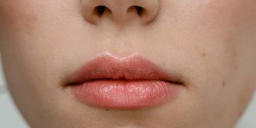 Cáncer de labio: una amenaza poco común pero peligrosa si se ignora