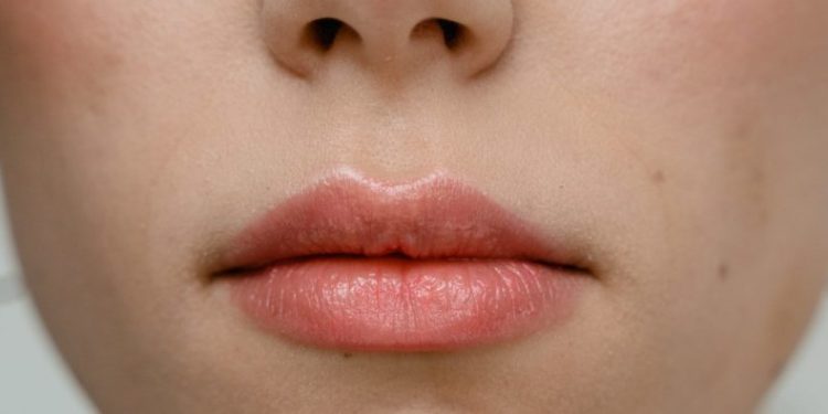 Cáncer de labio: una amenaza poco común pero peligrosa si se ignora