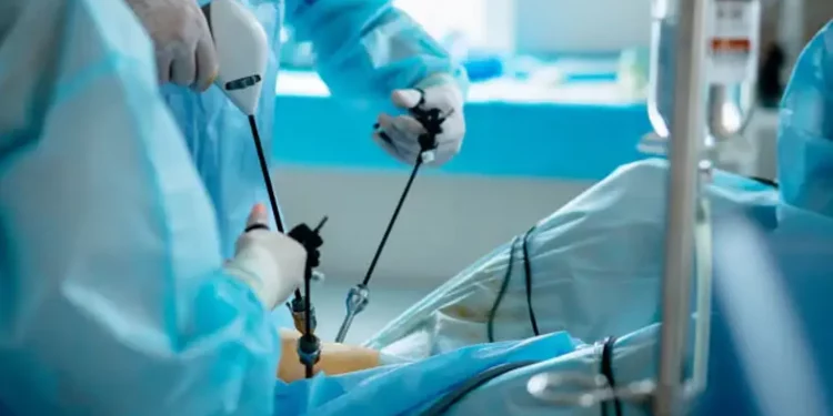 Laparoscopía: la cirugía que revoluciona la medicina con menos riesgos y recuperación rápida