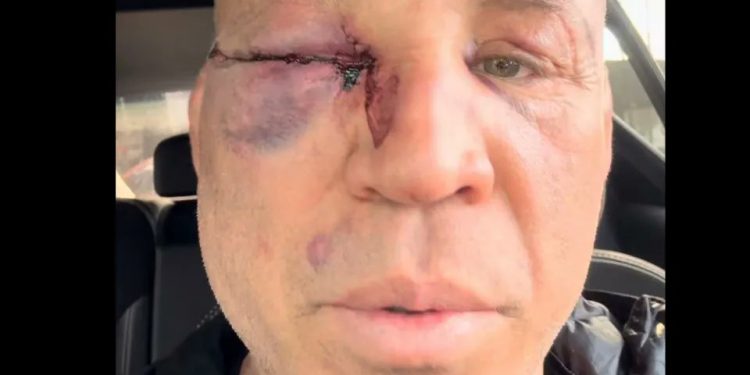 Caos en Sao Paulo: Wanderlei Silva termina noqueado en pelea de exhibición contra ‘Popó’ Freitas