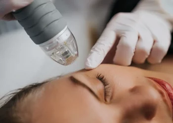 ¿Qué láser dermatológico necesitas? Conoce las opciones más efectivas para cuidar tu piel