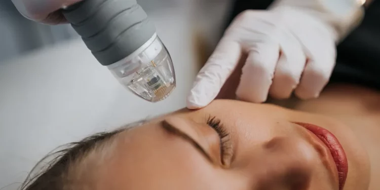 ¿Qué láser dermatológico necesitas? Conoce las opciones más efectivas para cuidar tu piel