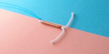 El DIU: uno de los métodos anticonceptivos más eficaces y duraderos para las mujeres