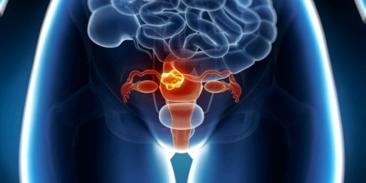 Cáncer de cérvix: claves para prevenirlo y detectarlo a tiempo