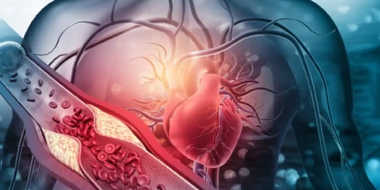 Colesterol alto: hábitos diarios que debes adoptar (y evitar) para proteger tu corazón