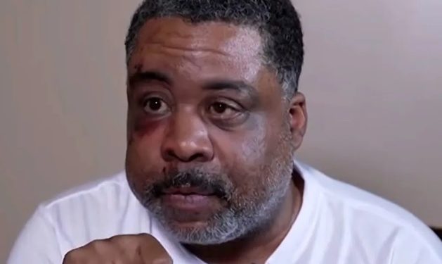 Hombre agredido por detectives en Brooklyn demanda al NYPD por 100 millones de dólares