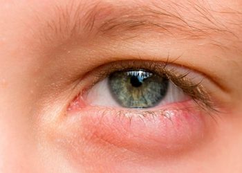 Alergia o infección en los ojos: cómo identificar la diferencia y cuándo acudir al especialista