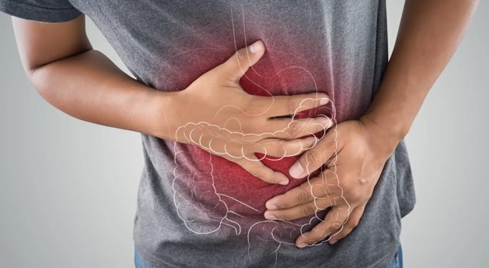 Aumenta en NYC cáncer de colon menores de 50 años; hay creciente comunidad dominicana en esas edades
