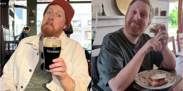 Muere actor de “Game of Thrones” tras padecer enfermedad neurodegenerativa