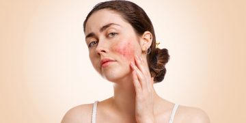Lupus: la enfermedad silenciosa que puede tardar años en ser detectada