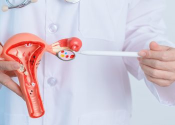 Nuevos tratamientos ofrecen esperanza frente al cáncer de ovario