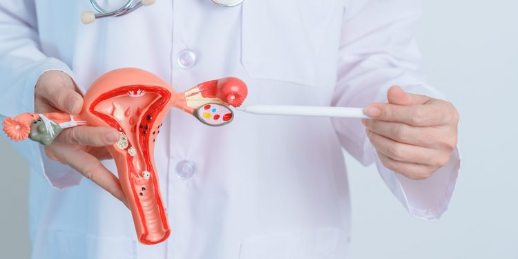 Nuevos tratamientos ofrecen esperanza frente al cáncer de ovario