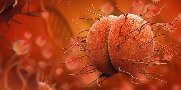 Gonorrea: qué es, síntomas, tratamiento y cómo prevenir esta infección de transmisión sexual