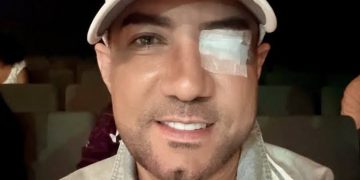 Marcos Yaroide se recupera tras ser operado de emergencia por desprendimiento de retina