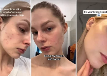 “Glass skin” bajo alerta: la tendencia viral que promete piel perfecta puede terminar dañándola