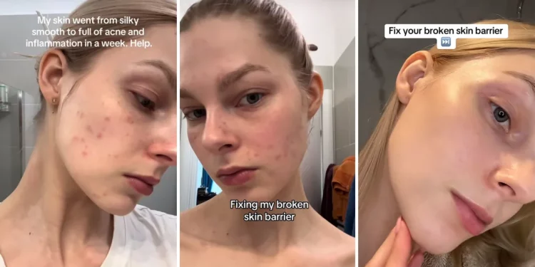“Glass skin” bajo alerta: la tendencia viral que promete piel perfecta puede terminar dañándola