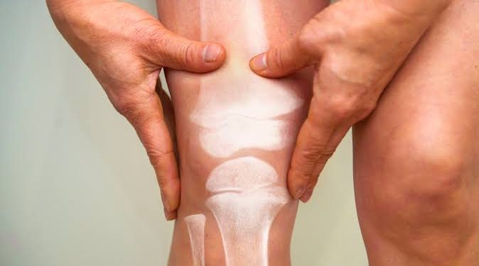 ¿Qué le pasa a tu cuerpo cuando no consumes suficiente calcio? Las señales y riesgos que debes conocer